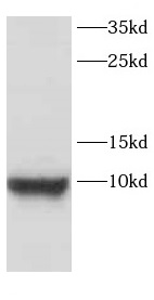 CARTPT antibody|CARTPT抗体