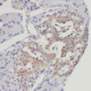 CHGB antibody|CHGB抗体