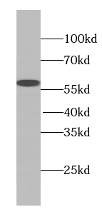 TTC31 antibody|TTC31抗体