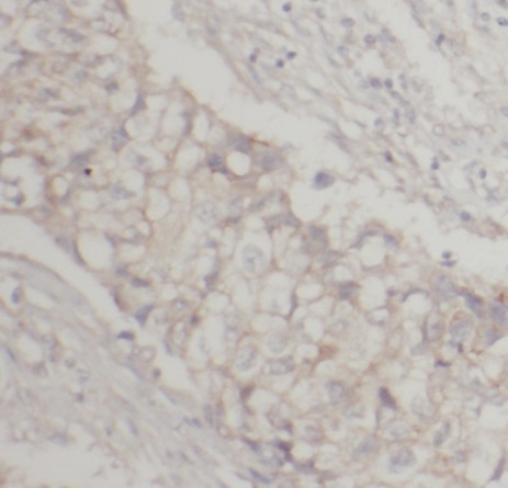 ICAM1 antibody|ICAM1抗体 FNab041
