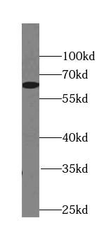 MKKS antibody|MKKS抗体