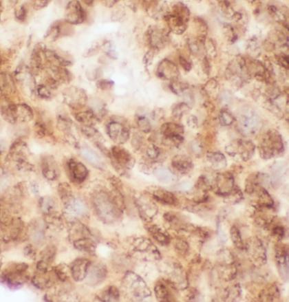 LMNA antibody|LMNA抗体