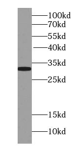 STX17 antibody|STX17抗体