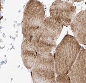 TRIM41 antibody|TRIM41抗体