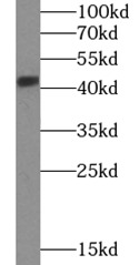 SH3GL1 antibody|SH3GL1抗体