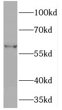 PDIA5 antibody|PDIA5抗体