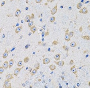 MSRA antibody|MSRA抗体