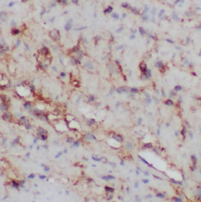 MYF5 antibody|MYF5抗体