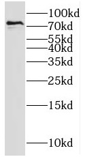 SH2D3C antibody|SH2D3C抗体