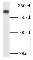 POLR1A antibody|POLR1A抗体