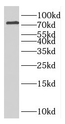 GFPT2 antibody|GFPT2抗体