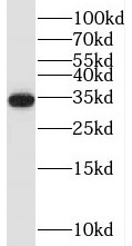 TRA2A antibody|TRA2A抗体