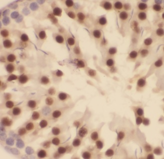 CARF antibody|CARF抗体