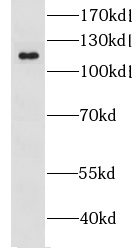 GRIK2 antibody|GRIK2抗体