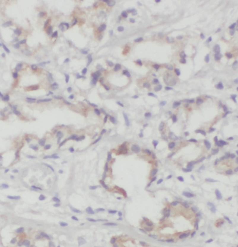 PITPNB antibody|PITPNB抗体