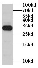 MYOZ1 antibody|MYOZ1抗体