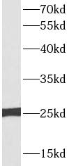 TFAM antibody|TFAM抗体 FNab08615