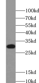 VDAC1 antibody|VDAC1抗体 FNab093