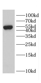 CD2 antibody|CD2抗体 FNab01438