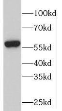PFKFB2 antibody|PFKFB2抗体