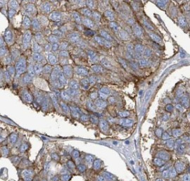 PLSCR1 antibody|PLSCR1抗体