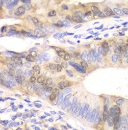 UBE2C antibody|UBE2C抗体 FNab091