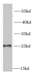 MSRA antibody|MSRA抗体