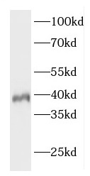 ELOVL4 antibody|ELOVL4抗体