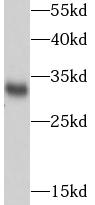 SDHB antibody|SDHB抗体