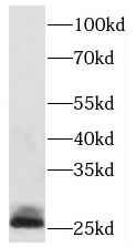 PAFAH1B3 antibody|PAFAH1B3抗体 F