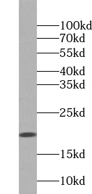 UBL4A antibody|UBL4A抗体