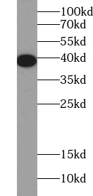 A4GNT antibody|A4GNT抗体