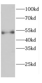 CARD9 antibody|CARD9抗体