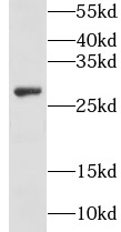 GSTO2 antibody|GSTO2抗体
