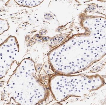 TEX101 antibody|TEX101抗体