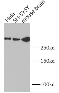 HTT antibody|HTT抗体