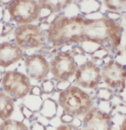 SHOC2 antibody|SHOC2抗体