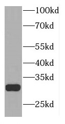 TLCD3B antibody|TLCD3B抗体