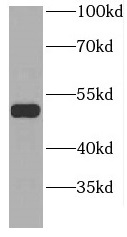 GDI2 antibody|GDI2抗体 FNab03406
