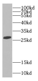 C9orf72 antibody|C9orf72抗体 FNa