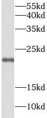 CLDN1 antibody|CLDN1抗体