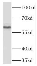 TBX21 antibody|TBX21抗体