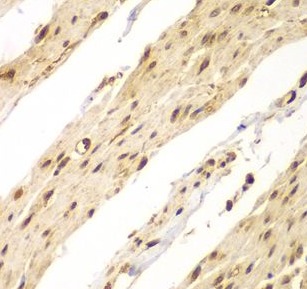 CDX1 antibody|CDX1抗体