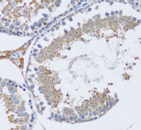 TNFSF12 antibody|TNFSF12抗体