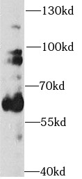 TH antibody|TH抗体 FNab08655