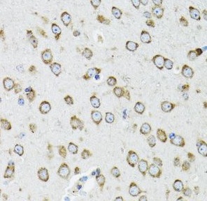 OGDH antibody|OGDH抗体