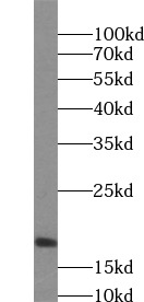 SRP14 antibody|SRP14抗体