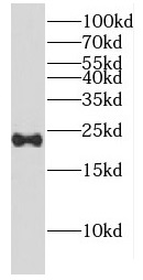 CPLX2 antibody|CPLX2抗体 FNab019