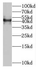 SLC35F2 antibody|SLC35F2抗体