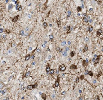 ASRGL1 antibody|ASRGL1抗体